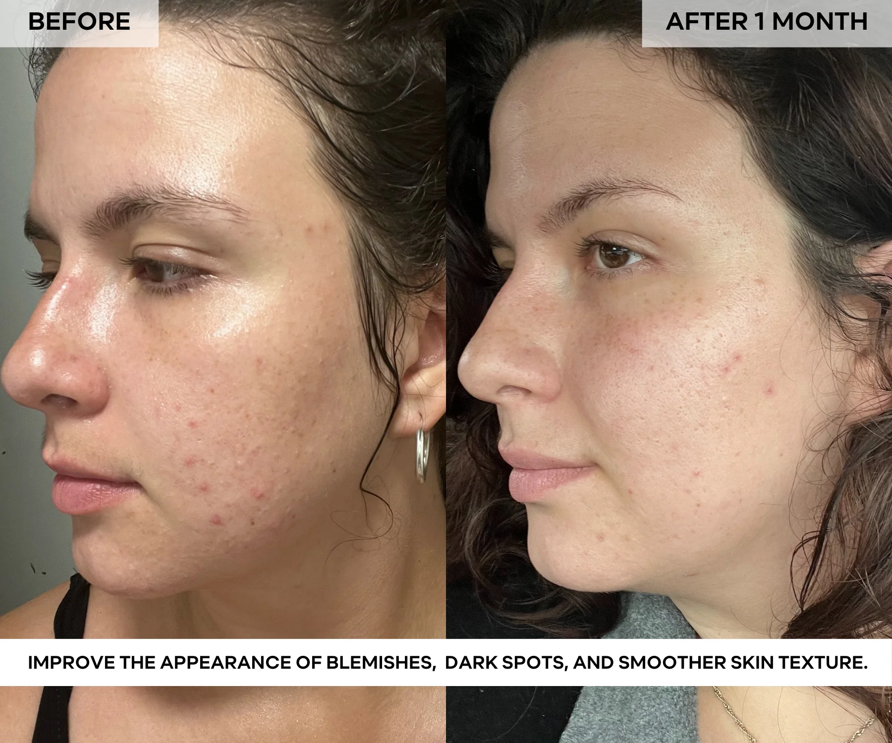 BEAUTY POPS™ Glow Enzyme Frozen Mask Kit - Image 3