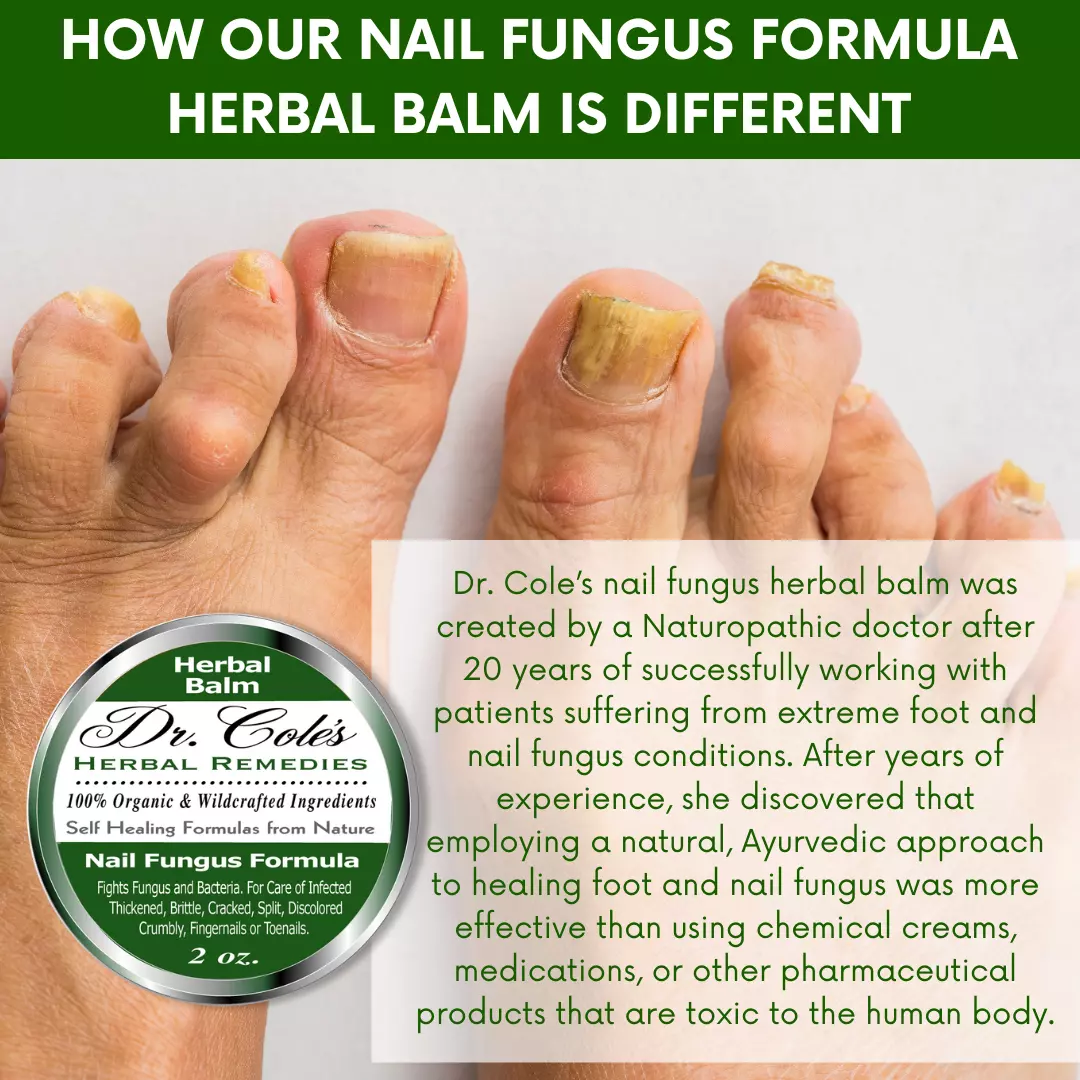 12 - Dr. Cole's Nail Fungus Balm - Image 12