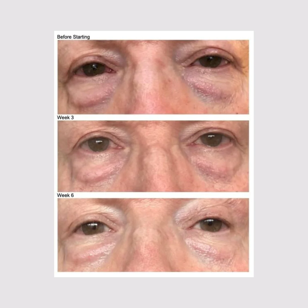 Firming Eye Cream - Image 9