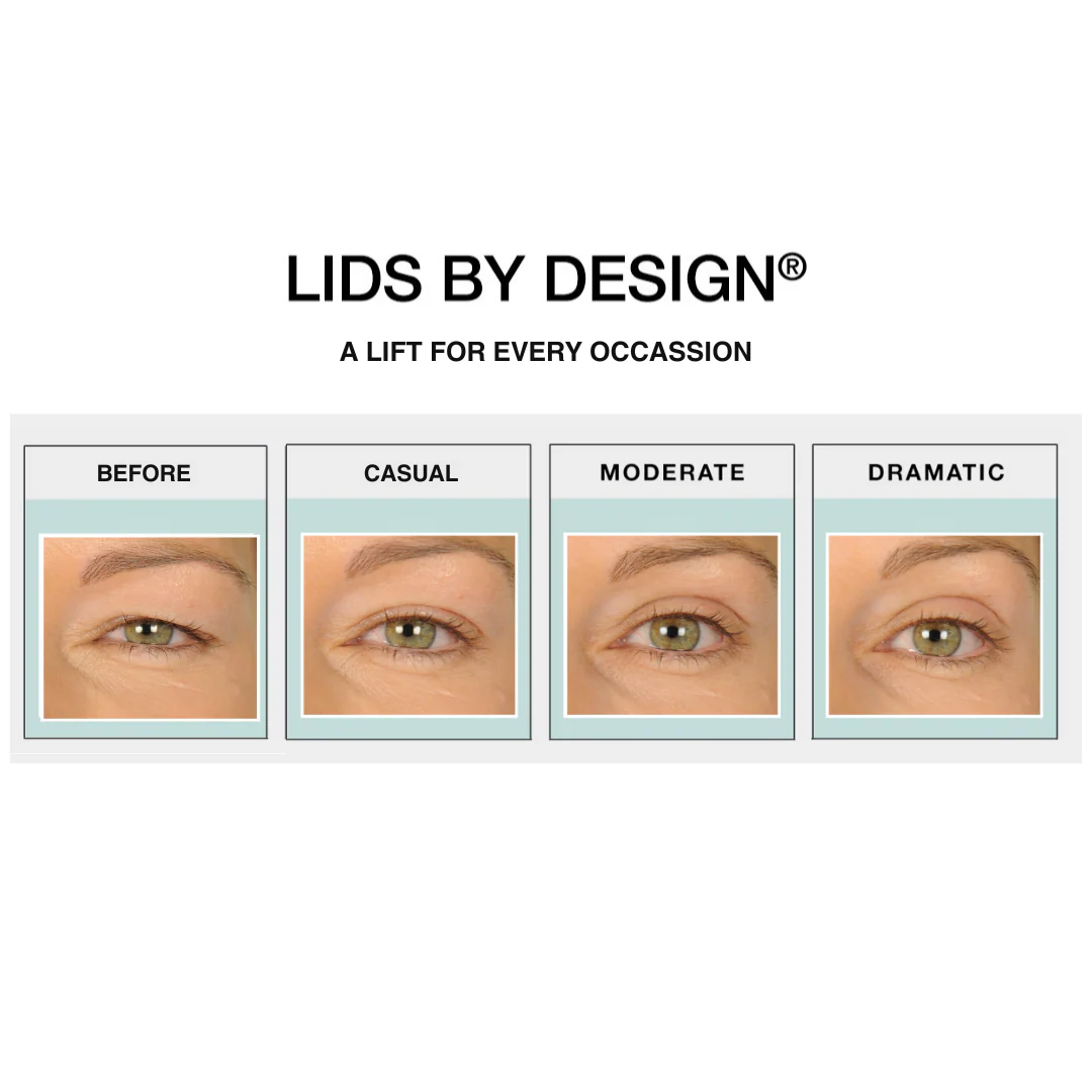 Lids By Design Assortment Pack - Image 3