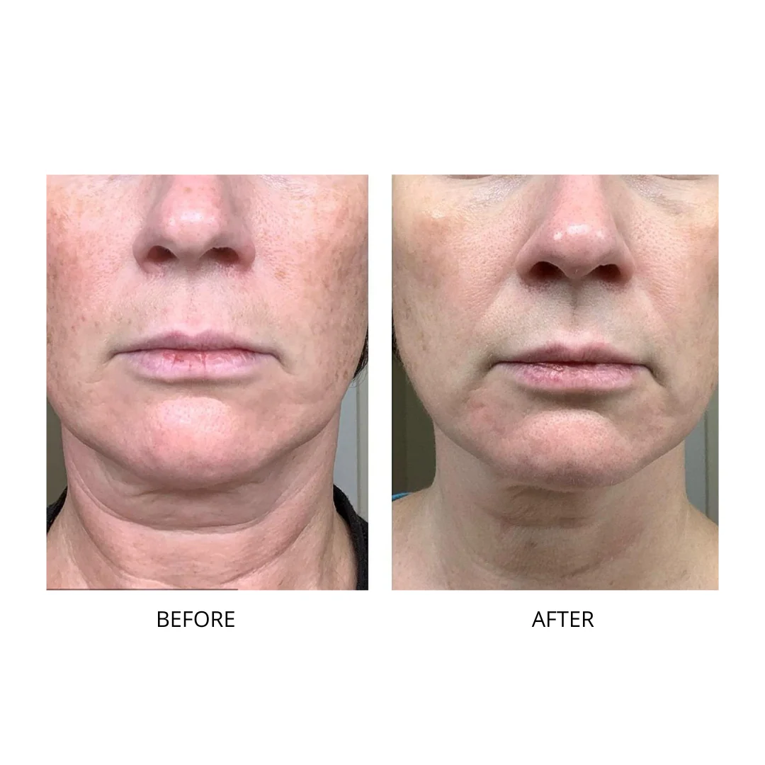 Neck Firming Cream - Image 10