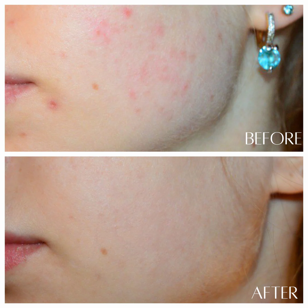 No. 5 RECOVER - HydroFlora Balancing Mist - Image 3