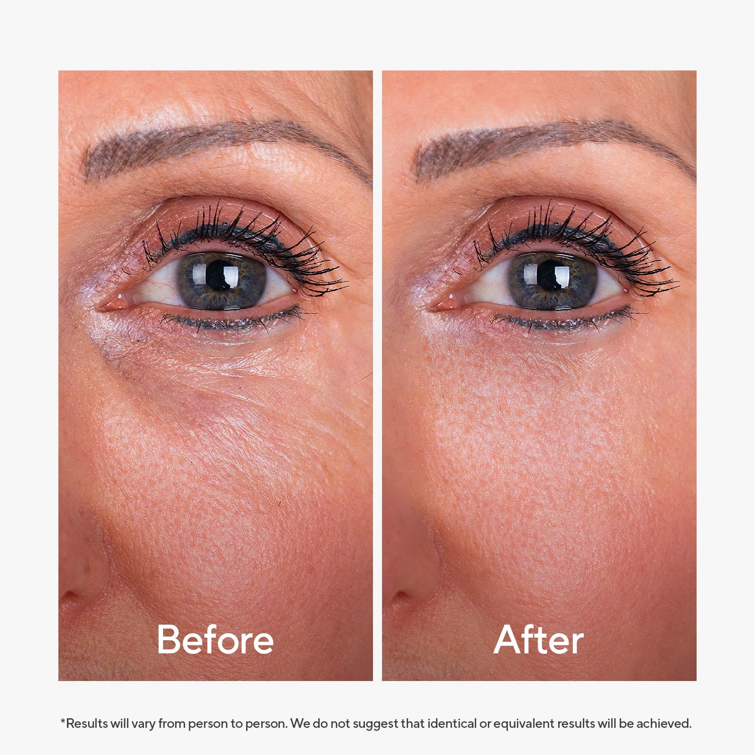 Super Peptide Eye Serum - Image 7