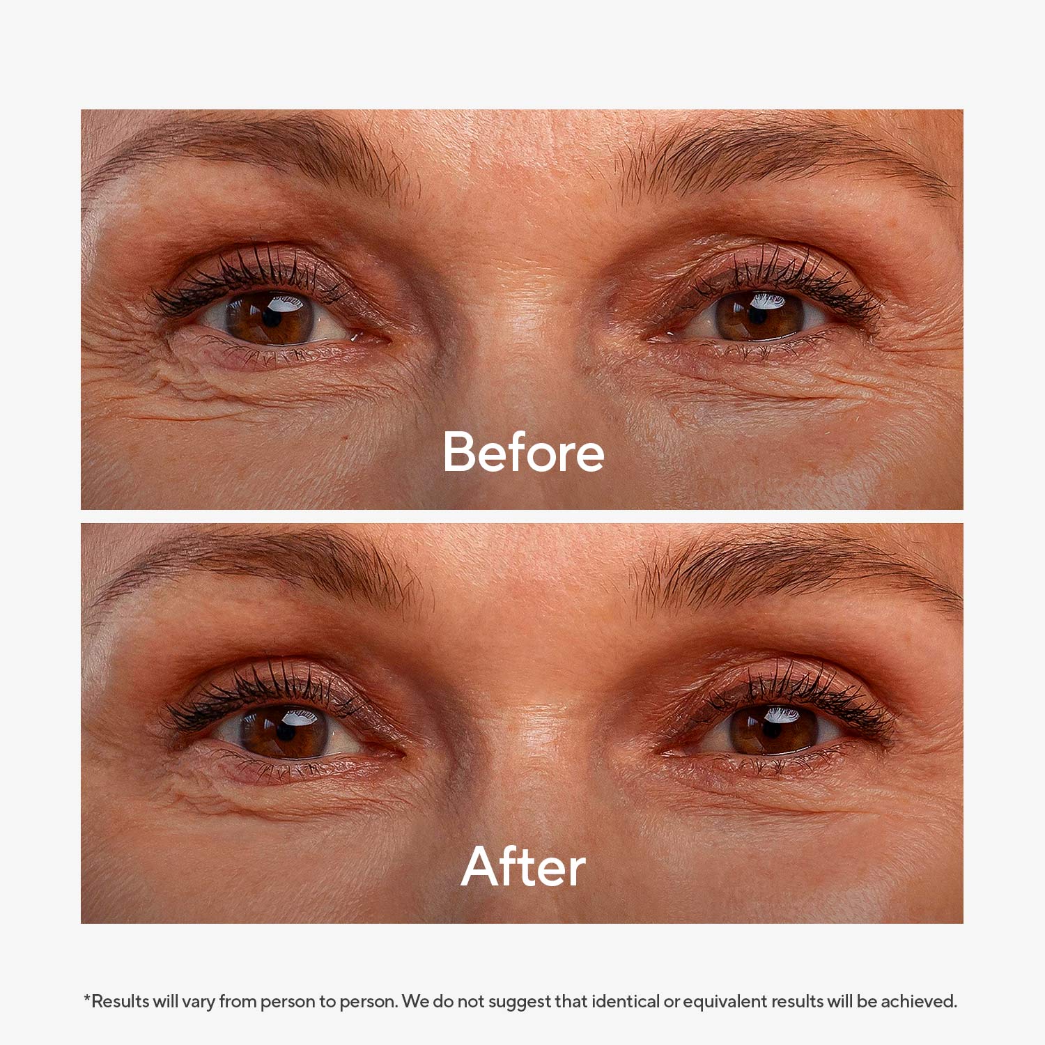 Super Peptide Eye Serum - Image 8