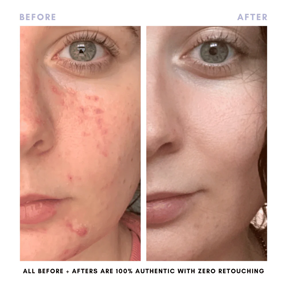 The Skin Reset Starter Kit - Image 8